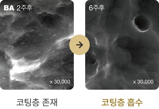 더스퀘어치과 | 프리미엄 임플란트 서비스 나노 코팅으로 기존 SA 표면 대비 30% 이상 골유착 성능 향상