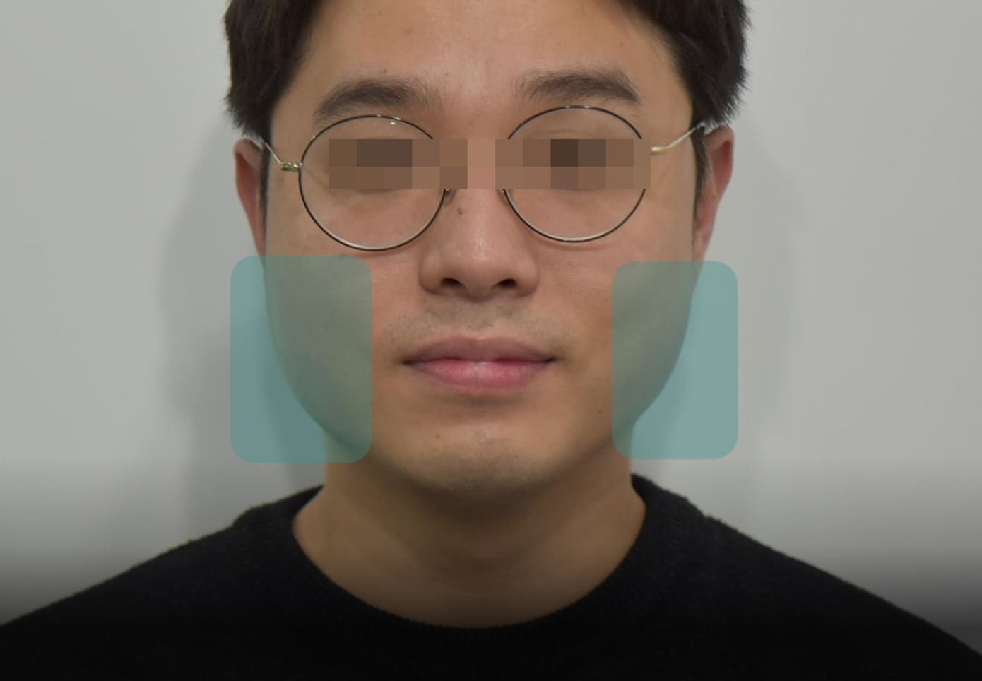 더스퀘어치과 | 이갈이 증상 확인