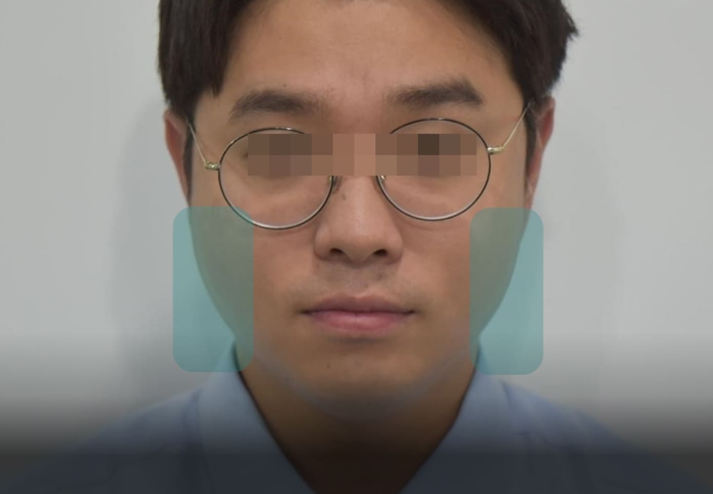 더스퀘어치과 | 이갈이 증상 확인
