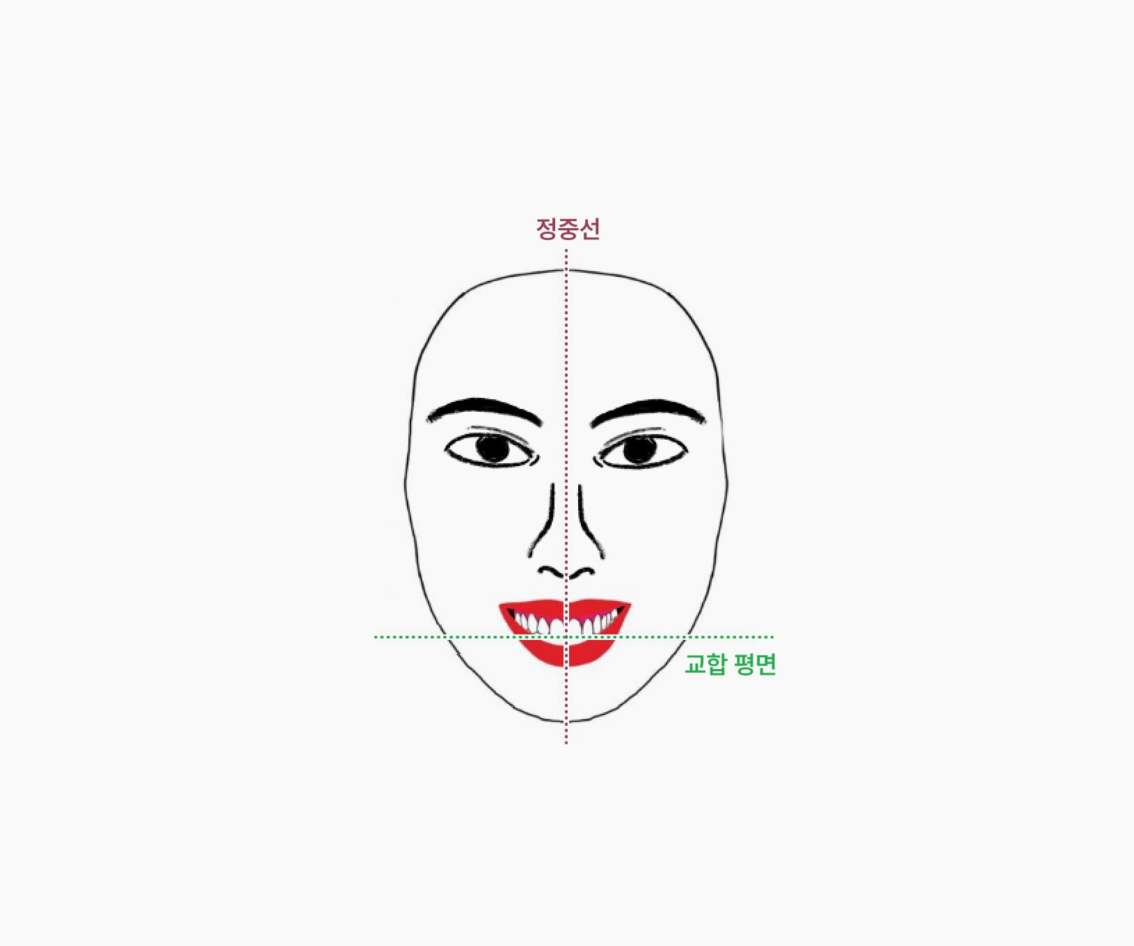 더스퀘어치과 | 더스퀘어치과의 얼굴 옆모습 개선 비대칭
