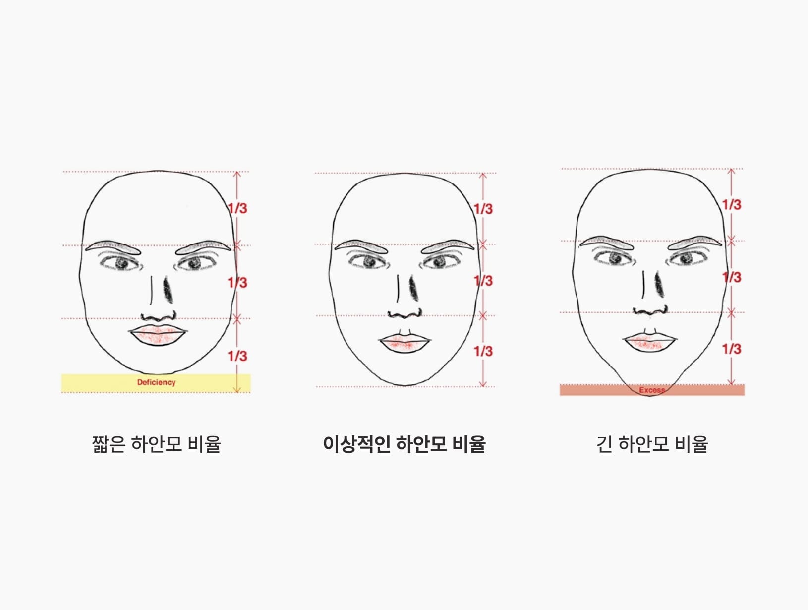 더스퀘어치과 | 더스퀘어치과의 얼굴 비율 개선