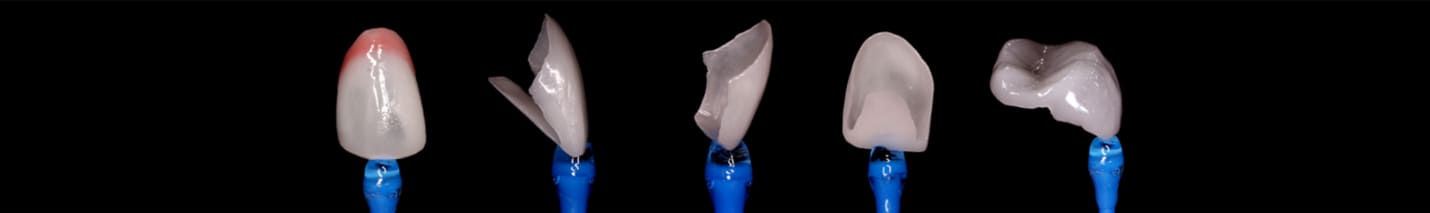 더스퀘어치과 | 미니쉬 하이브리드 솔루션 개별 제작