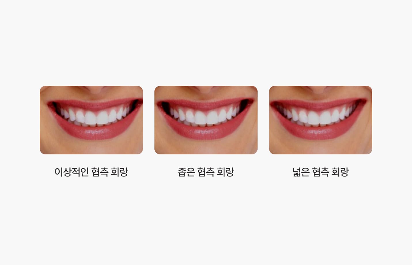 더스퀘어치과 | 협측회랑