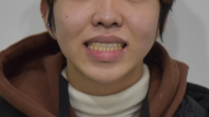 인비절라인